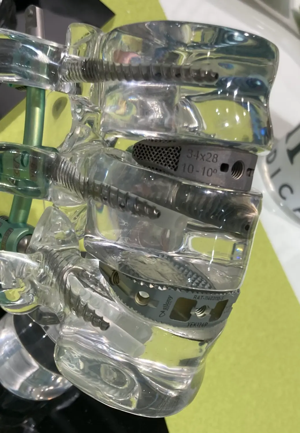 Osteochondrose (Spondylodese) von Dr. Wanke Ortho.Spine