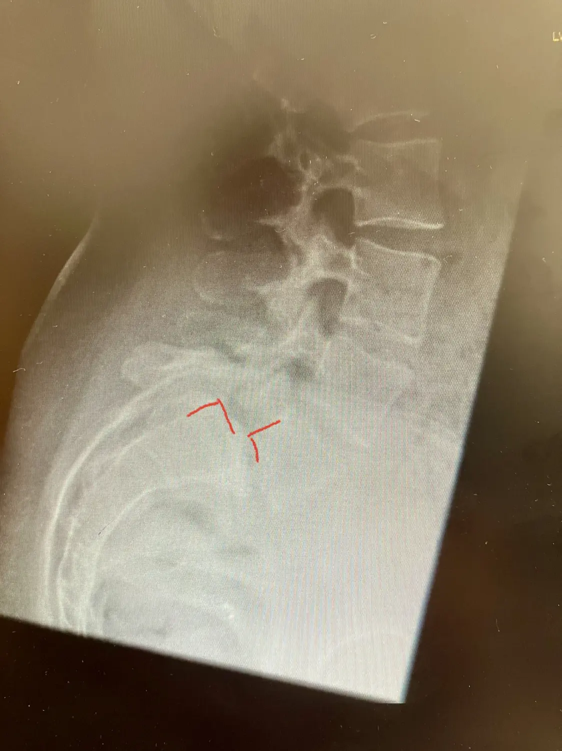 Therapiemöglichkeiten von Dr. Wanke Ortho.Spine