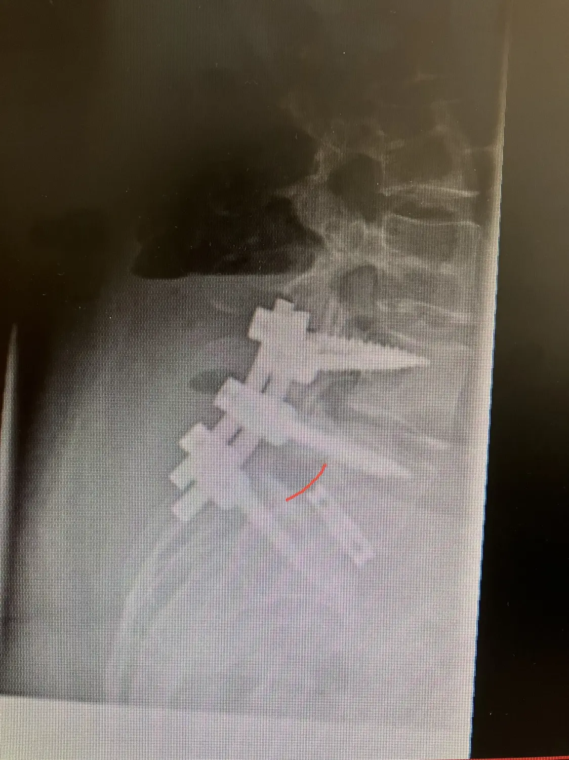 Therapiemöglichkeiten von Dr. Wanke Ortho.Spine